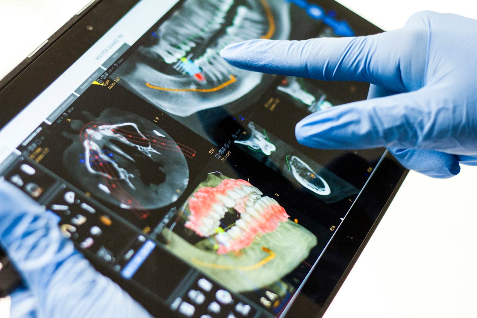 http://Clinician%20reviewing%20a%20dental%20scan%20on%20a%20tablet
